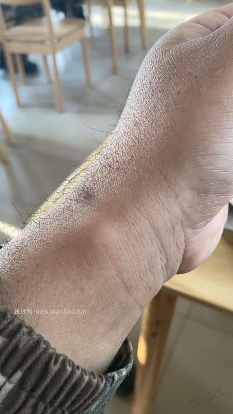 这包是不是玩手机玩多了，疼，影响我撸猫 - 线报酷