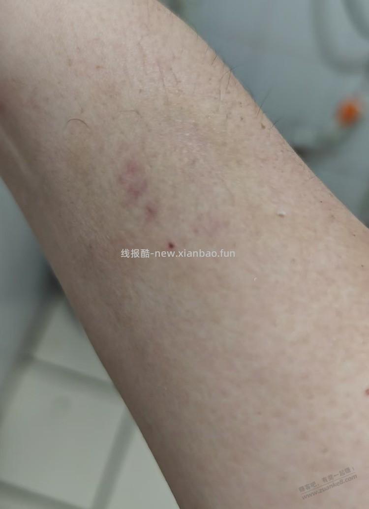 结婚六年了 ，被家暴了十多次，今天我终于还手，把我对象打了，我忍了六年了 - 线报酷