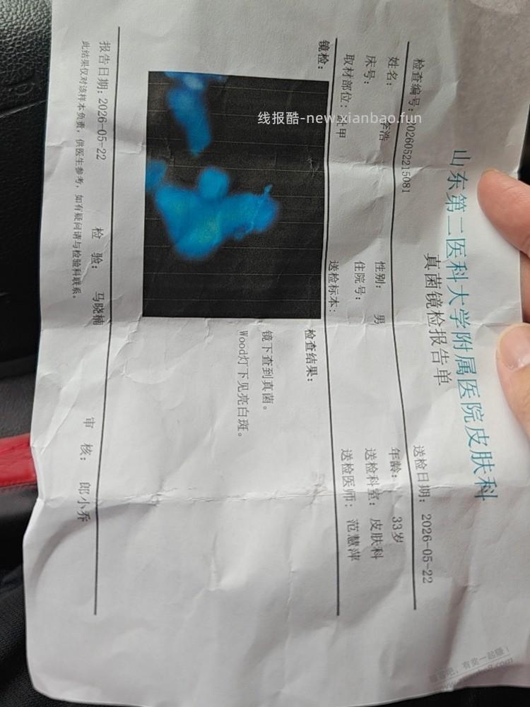 吧里有甲癣 治好的吗？哎喝了7个疗程 伊曲康挫了还没好 愁死了 - 线报酷
