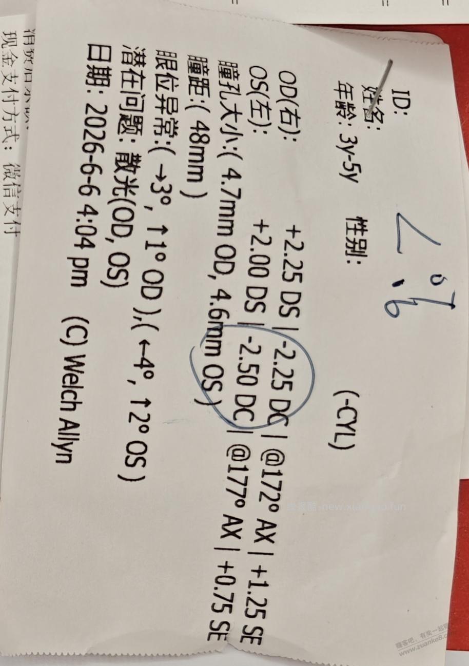 这种情况是不是必须配镜了啊 - 线报酷 这种情况是不是必须配镜了啊 - 线报酷