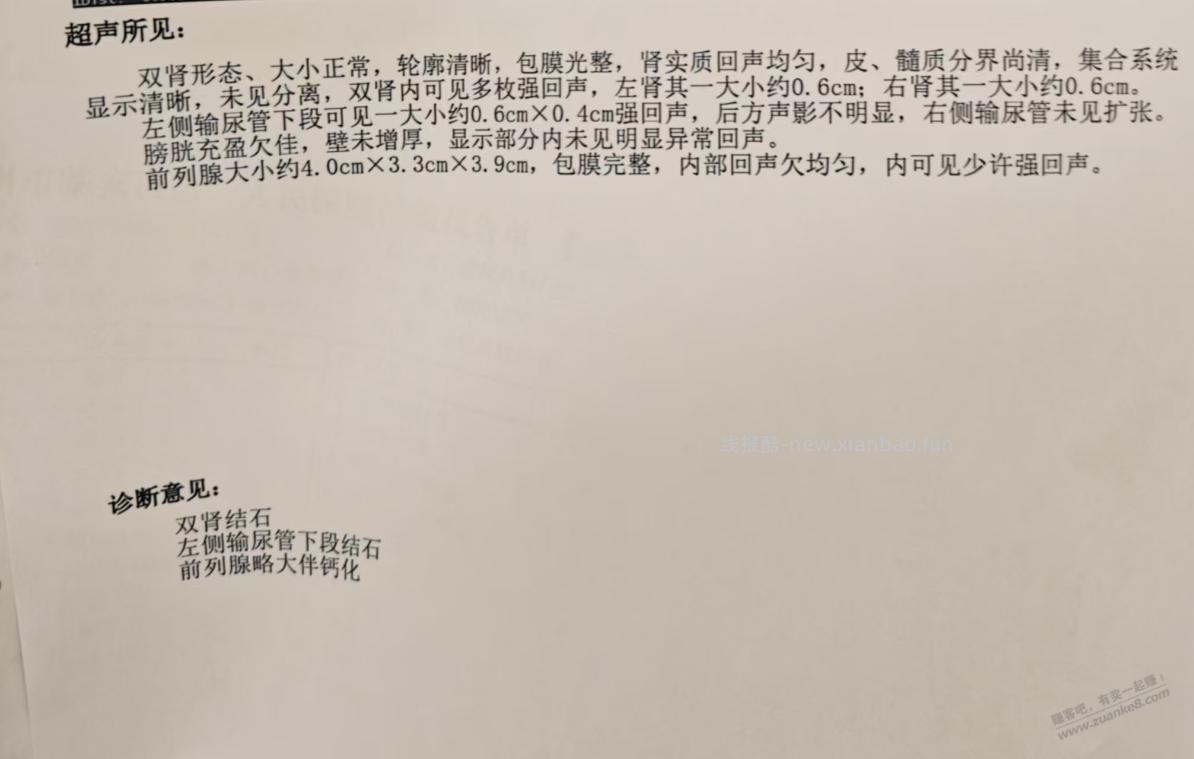 今天去了三家医院决定体外碎石了 - 线报酷