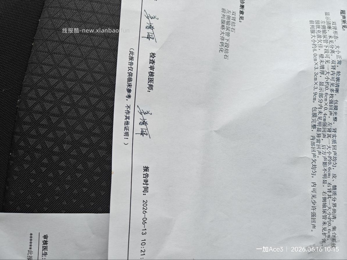 吧里肾结石，输尿管结石的看过来，干货 - 线报酷