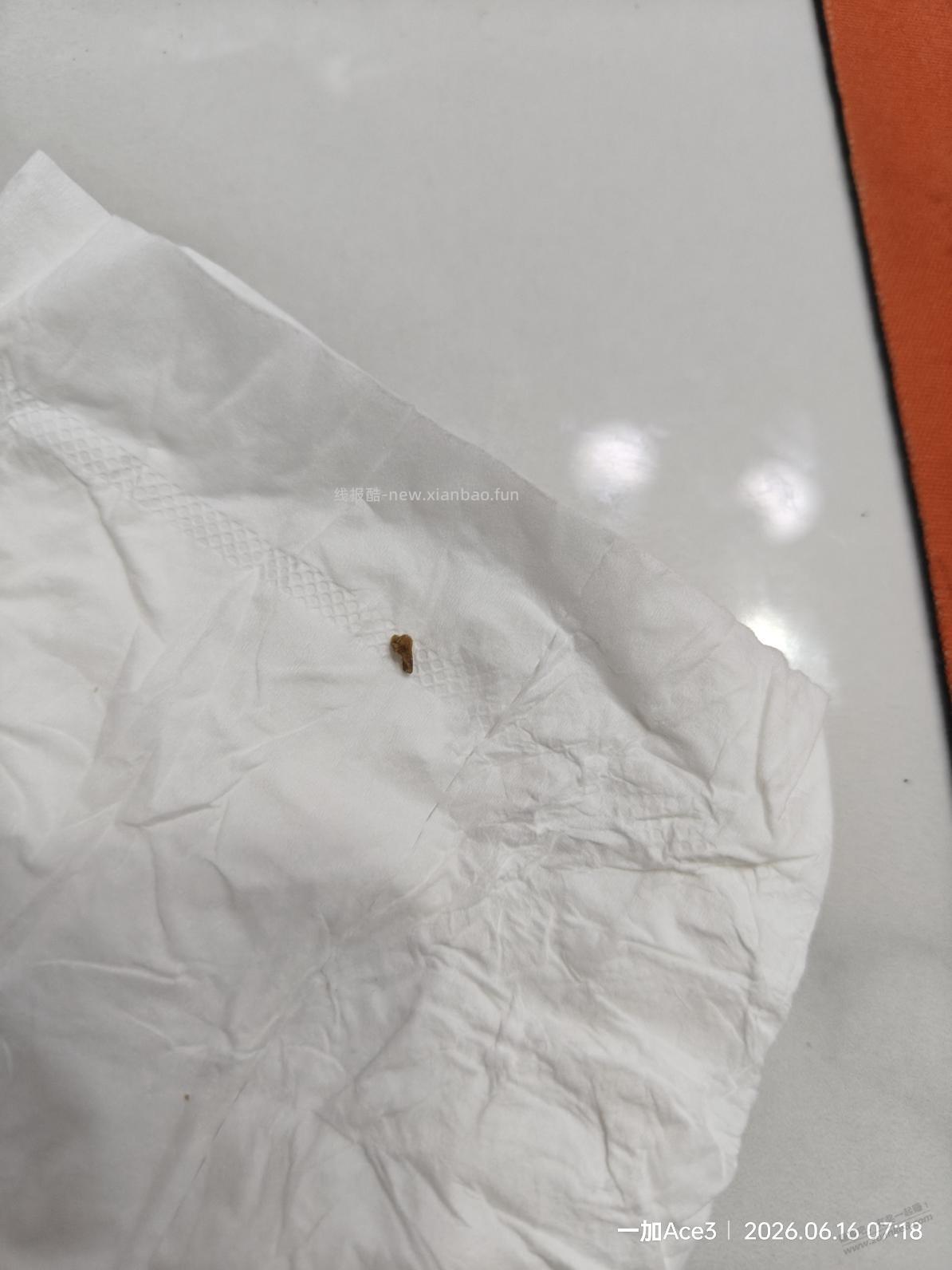 吧里肾结石，输尿管结石的看过来，干货 - 线报酷
