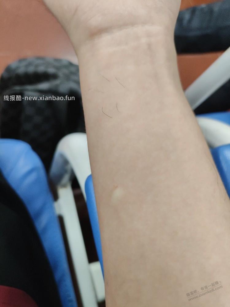 被昂刺鱼刺了一刀，去医院做皮试打蛋白，酸爽 - 线报酷